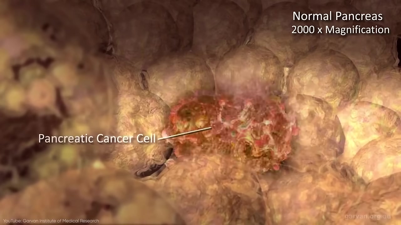 Cancer cell image from the source video comparing contract failure inside a body